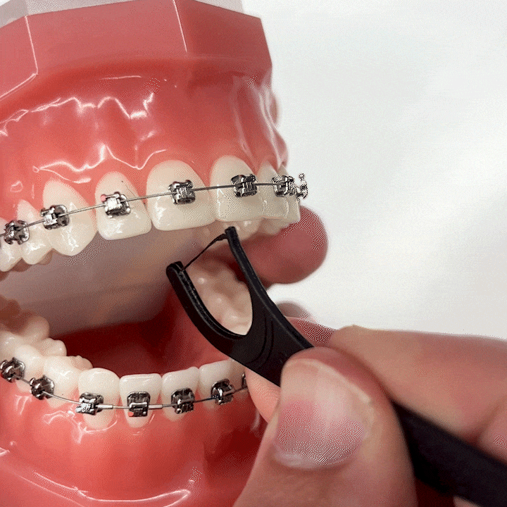 Versa Floss Picks for Braces